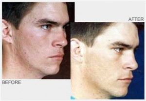 Before & After 3