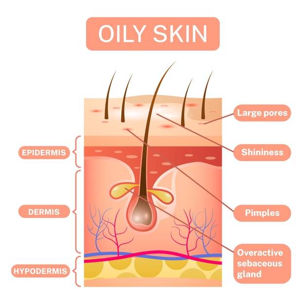 Can Pregnancy Cause Oily Skin And Hair